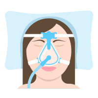 Sleep Apnea