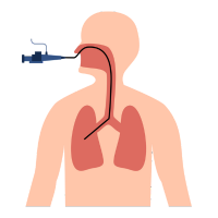 Esophagoscopy, Bronchoscopy
